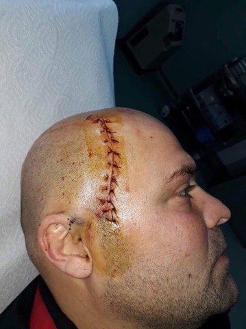 დაჭრილი ზვიად მესხი